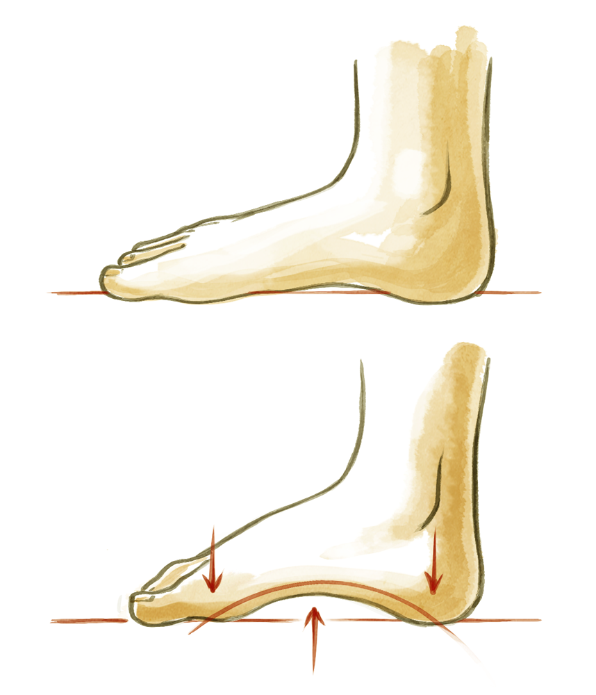 Tendinopathie Übung 3